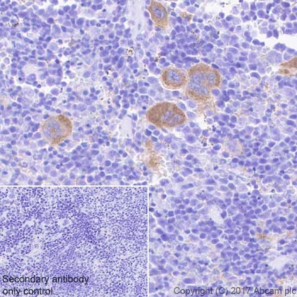 Immunohistochemistry (Formalin/PFA-fixed paraffin-embedded sections) - Anti-Integrin beta antibody [EPR20825] (AB210515), expandable thumbnail