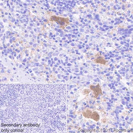 Immunohistochemistry (Formalin/PFA-fixed paraffin-embedded sections) - Anti-Integrin beta antibody [EPR20825] (ab210515), expandable thumbnail