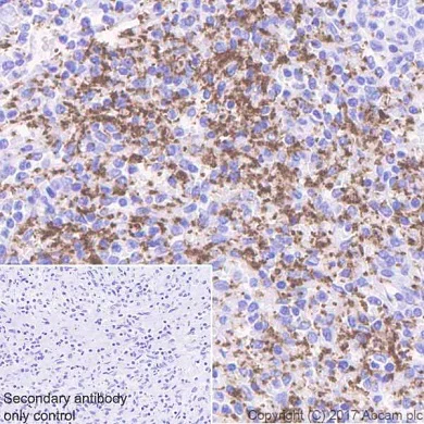 Immunohistochemistry (Formalin/PFA-fixed paraffin-embedded sections) - Anti-Integrin beta antibody [EPR20825] - BSA and Azide free (AB225742)