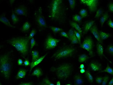 Immunocytochemistry/ Immunofluorescence - Anti-Integrin linked ILK antibody (AB217025)