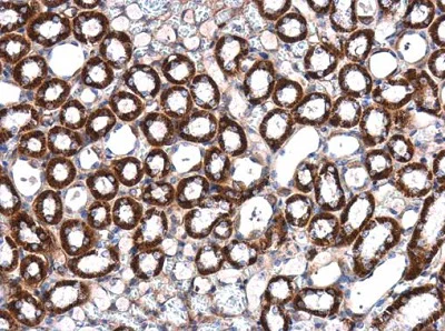 Immunohistochemistry (Formalin/PFA-fixed paraffin-embedded sections) - Anti-Integrin linked ILK antibody (AB227154)