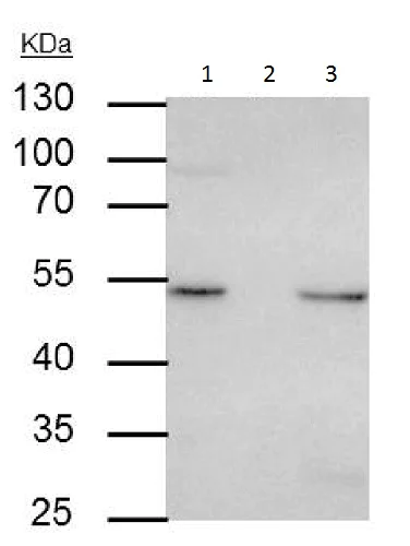 Immunoprecipitation - Anti-Integrin linked ILK antibody (AB227154)