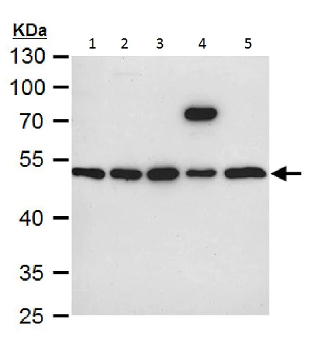 Western blot - Anti-Integrin linked ILK antibody (AB227154)