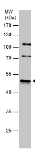 Western blot - Anti-Integrin linked ILK antibody (AB227154)