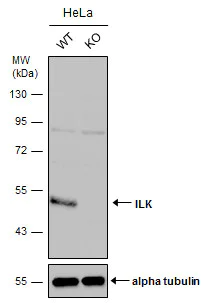 Western blot - Anti-Integrin linked ILK antibody (AB227154)