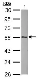 Western blot - Anti-Integrin linked ILK antibody (AB227154)