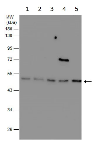 Western blot - Anti-Integrin linked ILK antibody (AB227154)