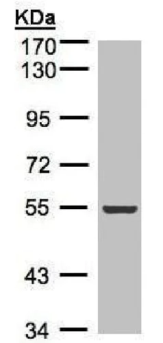 Western blot - Anti-Integrin linked ILK antibody (AB227154)