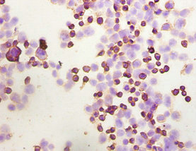 Immunocytochemistry - Anti-Integrin linked ILK antibody (AB236455)