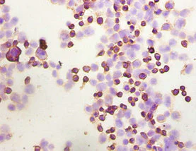 Immunocytochemistry - Anti-Integrin linked ILK antibody (AB236455)