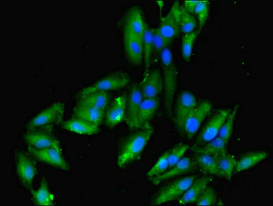 Immunocytochemistry/ Immunofluorescence - Anti-Integrin linked ILK antibody (AB236455)