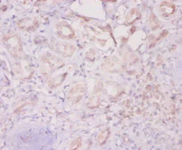 Immunohistochemistry (Formalin/PFA-fixed paraffin-embedded sections) - Anti-Integrin linked ILK antibody (AB236455)