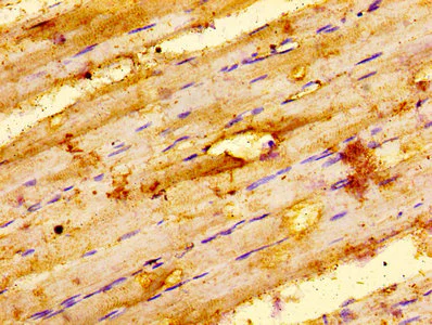 Immunohistochemistry (Formalin/PFA-fixed paraffin-embedded sections) - Anti-Integrin linked ILK antibody (AB236455)