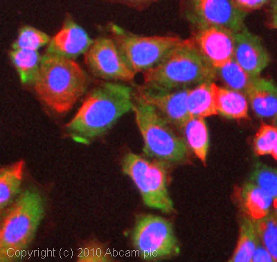 Immunocytochemistry/ Immunofluorescence - Anti-Integrin linked ILK antibody (AB74336)