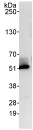 Immunoprecipitation - Anti-Integrin linked ILK antibody (AB74336)