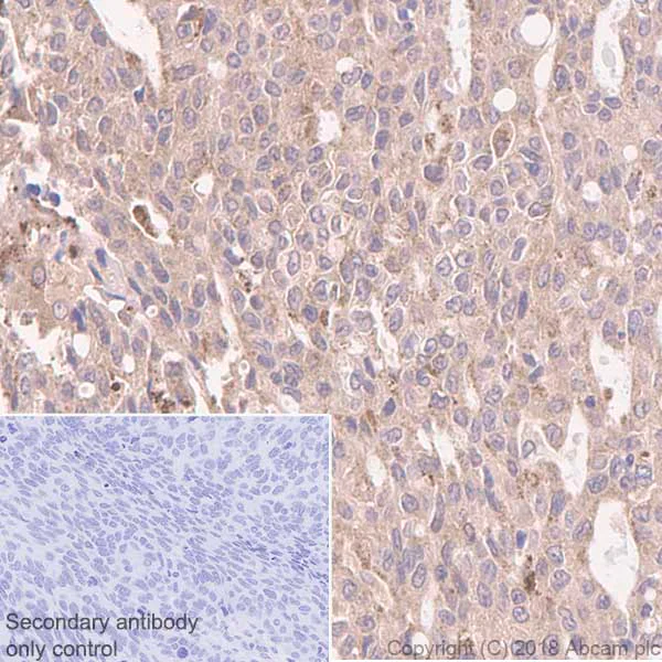 Immunohistochemistry (Formalin/PFA-fixed paraffin-embedded sections) - Anti-Integrin linked ILK antibody [EP1593Y] (AB52480)