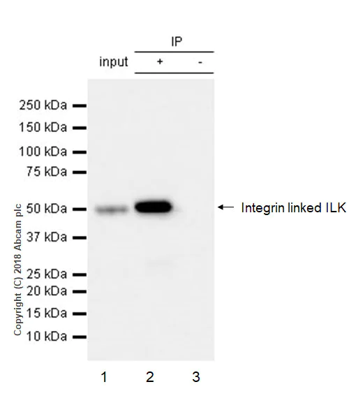 Immunoprecipitation - Anti-Integrin linked ILK antibody [EP1593Y] (AB52480)