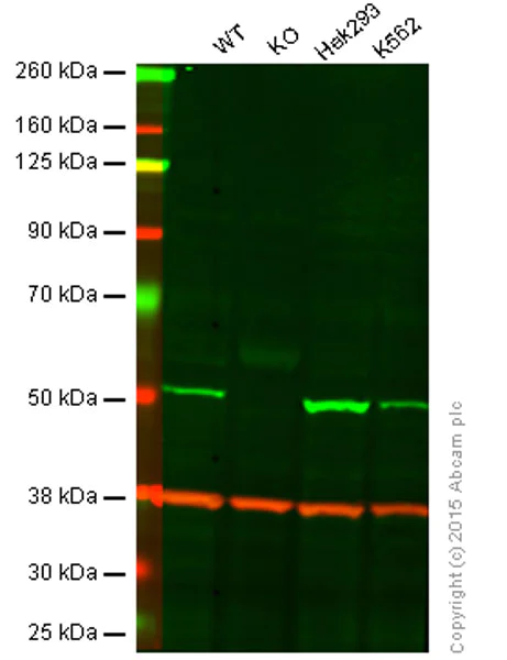Western blot - Anti-Integrin linked ILK antibody [EP1593Y] (AB52480)