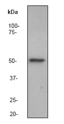 Western blot - Anti-Integrin linked ILK antibody [EP1593Y] (AB52480)