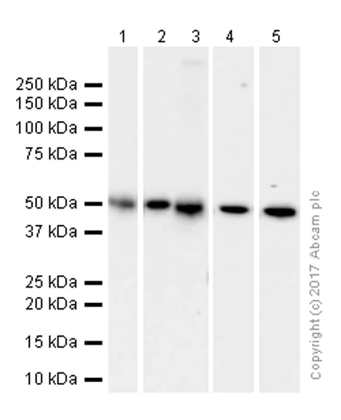 Western blot - Anti-Integrin linked ILK antibody [EP1593Y] (AB52480)