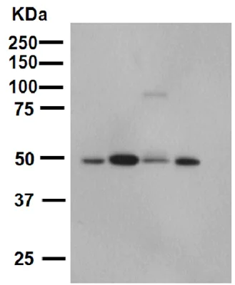 Western blot - Anti-Integrin linked ILK antibody [EP1593Y] (AB52480)