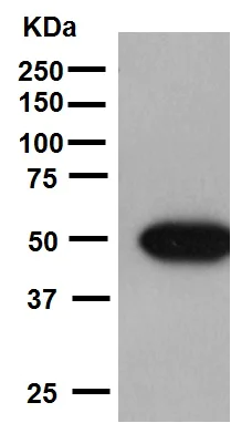 Western blot - Anti-Integrin linked ILK antibody [EP1593Y] (AB52480)