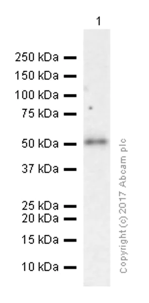 Western blot - Anti-Integrin linked ILK antibody [EP1593Y] (AB52480)