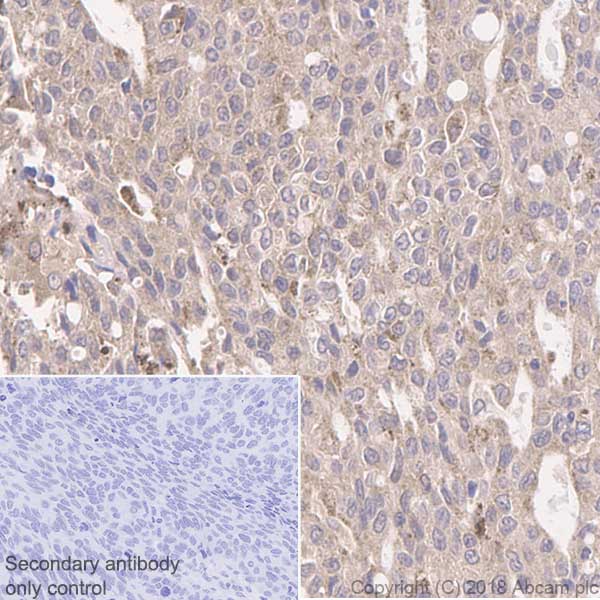 Immunohistochemistry (Formalin/PFA-fixed paraffin-embedded sections) - Anti-Integrin linked ILK antibody [EP1593Y] - Low endotoxin, Azide free (AB221922), expandable thumbnail
