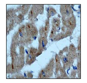 Immunohistochemistry (Formalin/PFA-fixed paraffin-embedded sections) - Anti-Integrin linked ILK antibody [EP1593Y] - Low endotoxin, Azide free (AB221922), expandable thumbnail
