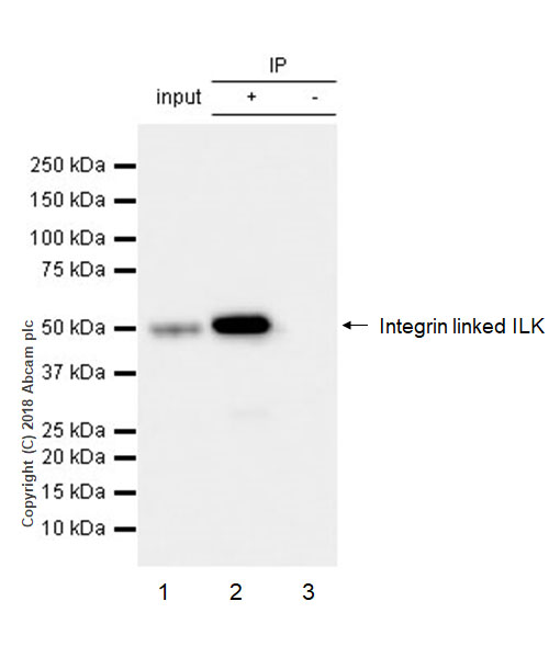 Immunoprecipitation - Anti-Integrin linked ILK antibody [EP1593Y] - Low endotoxin, Azide free (AB221922), expandable thumbnail