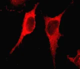 Immunocytochemistry/ Immunofluorescence - Anti-Integrin linked ILK antibody [EPR1592] (AB76468)