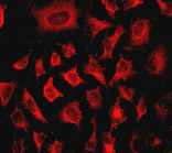 Immunocytochemistry/ Immunofluorescence - Anti-Integrin linked ILK antibody [EPR1592] (AB76468)