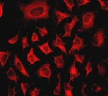 Immunocytochemistry/ Immunofluorescence - Anti-Integrin linked ILK antibody [EPR1592] (AB76468)