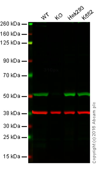 Anti-Integrin linked ILK antibody [EPR1592]