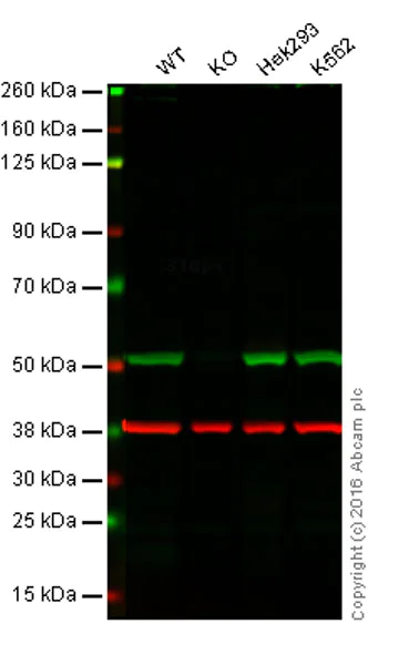 Western blot - Anti-Integrin linked ILK antibody [EPR1592] (AB76468)