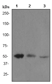 Western blot - Anti-Integrin linked ILK antibody [EPR1592] (AB76468)