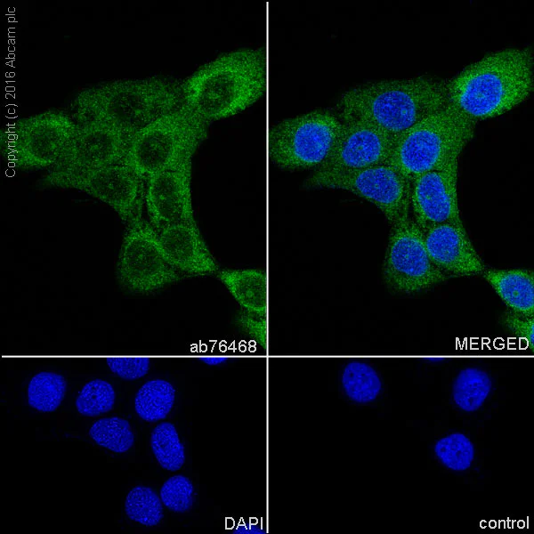 Immunocytochemistry/ Immunofluorescence - Anti-Integrin linked ILK antibody [EPR1592] - BSA and Azide free (AB239884)