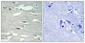 Immunohistochemistry (Formalin/PFA-fixed paraffin-embedded sections) - Anti-Integrin linked ILK (phospho S246) antibody (AB111435)
