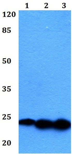 Western blot - Anti-Interferon alpha 1 antibody (AB191903)