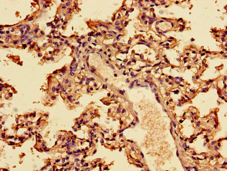 Immunohistochemistry (Formalin/PFA-fixed paraffin-embedded sections) - Anti-Interferon alpha 2 antibody (AB193055)