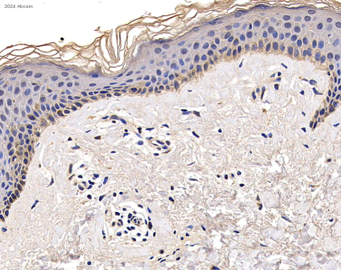 Immunohistochemistry (Formalin/PFA-fixed paraffin-embedded sections) - Anti-Interferon alpha 2 antibody (AB193055)