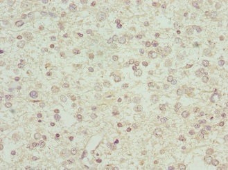 Immunohistochemistry (Formalin/PFA-fixed paraffin-embedded sections) - Anti-Interferon alpha 2 antibody (AB193055), expandable thumbnail