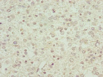 Immunohistochemistry (Formalin/PFA-fixed paraffin-embedded sections) - Anti-Interferon alpha 2 antibody (AB193055)