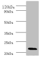 Western blot - Anti-Interferon alpha 2 antibody (AB193055), expandable thumbnail