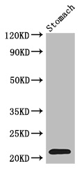 Western blot - Anti-Interferon alpha 2 antibody (AB193055), expandable thumbnail