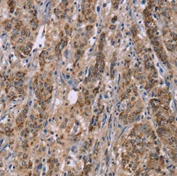 Immunohistochemistry (Formalin/PFA-fixed paraffin-embedded sections) - Anti-Interferon alpha 2 antibody (AB198914)