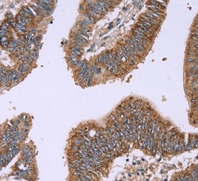 Immunohistochemistry (Formalin/PFA-fixed paraffin-embedded sections) - Anti-Interferon alpha 2 antibody (AB198914)