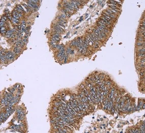 Immunohistochemistry (Formalin/PFA-fixed paraffin-embedded sections) - Anti-Interferon alpha 2 antibody (AB198914)