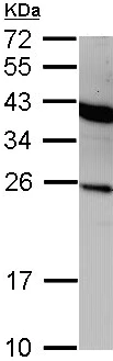 Western blot - Anti-Interferon alpha 2 antibody (AB97700)