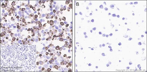 Immunocytochemistry - Anti-Interferon alpha 2 antibody [EPR19074] (AB196221)